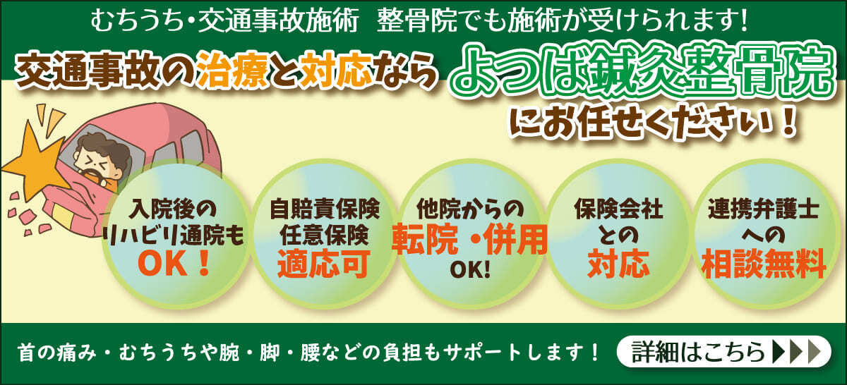 交通事故お任せください