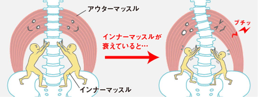 ぎっくり腰の状態